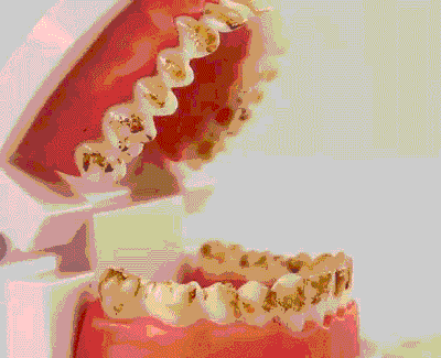 Dr White - Pulitore denti ad ultrasuoni